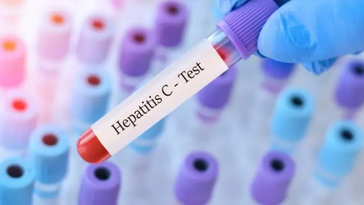 “Sağlıkçı” Gibi Kapı Kapı Gezip Hepatit C Bulaştırıyorlar: Uzmandan Kritik Uyarı