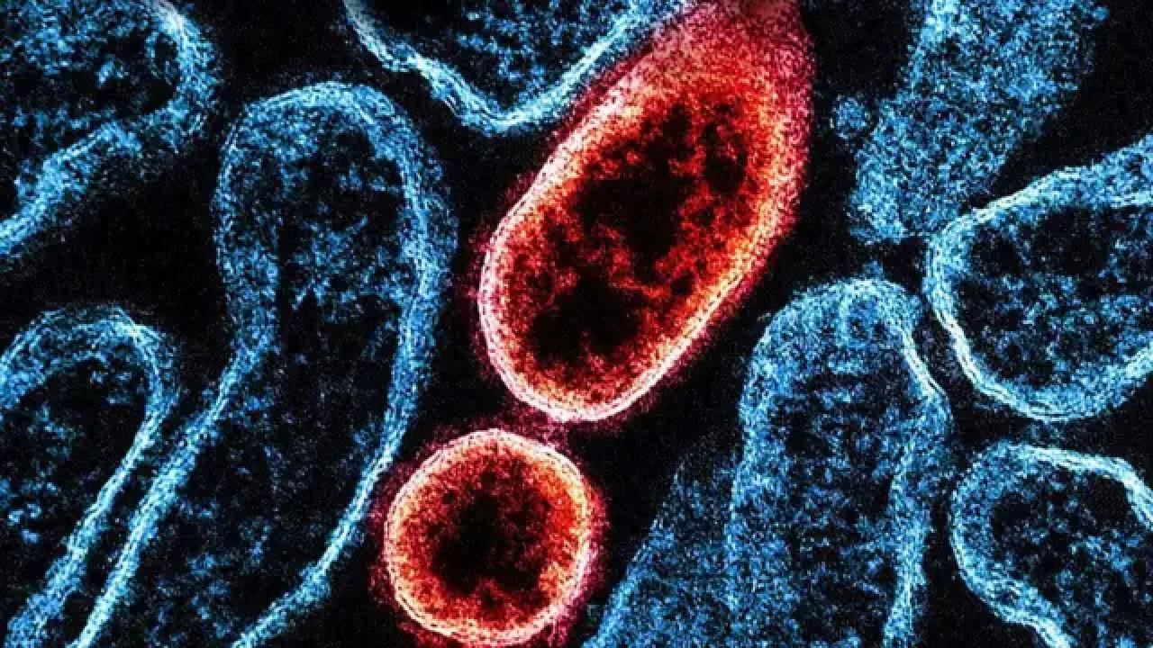 Hindistan’da Nipah Virüsü Alarmı: Batı Bengal’de Sağlık Önlemleri Artırıldı