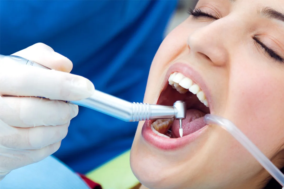 Tıpta devrim: Koyun yününden elde edilen keratinle diş çürükleri önlenebilecek